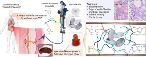 Innovative gel offers new hope for treating gastrointestinal leaks