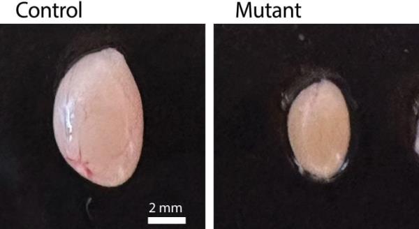 Normal Seminiferous Tubules in Co<em></em>ntrol Testes