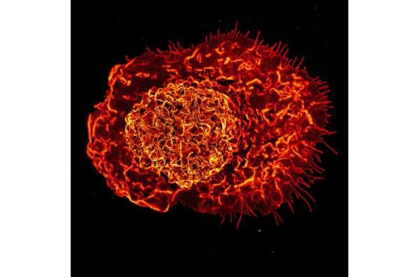 Severe COVID-19 may lead to long-term innate immune system changes